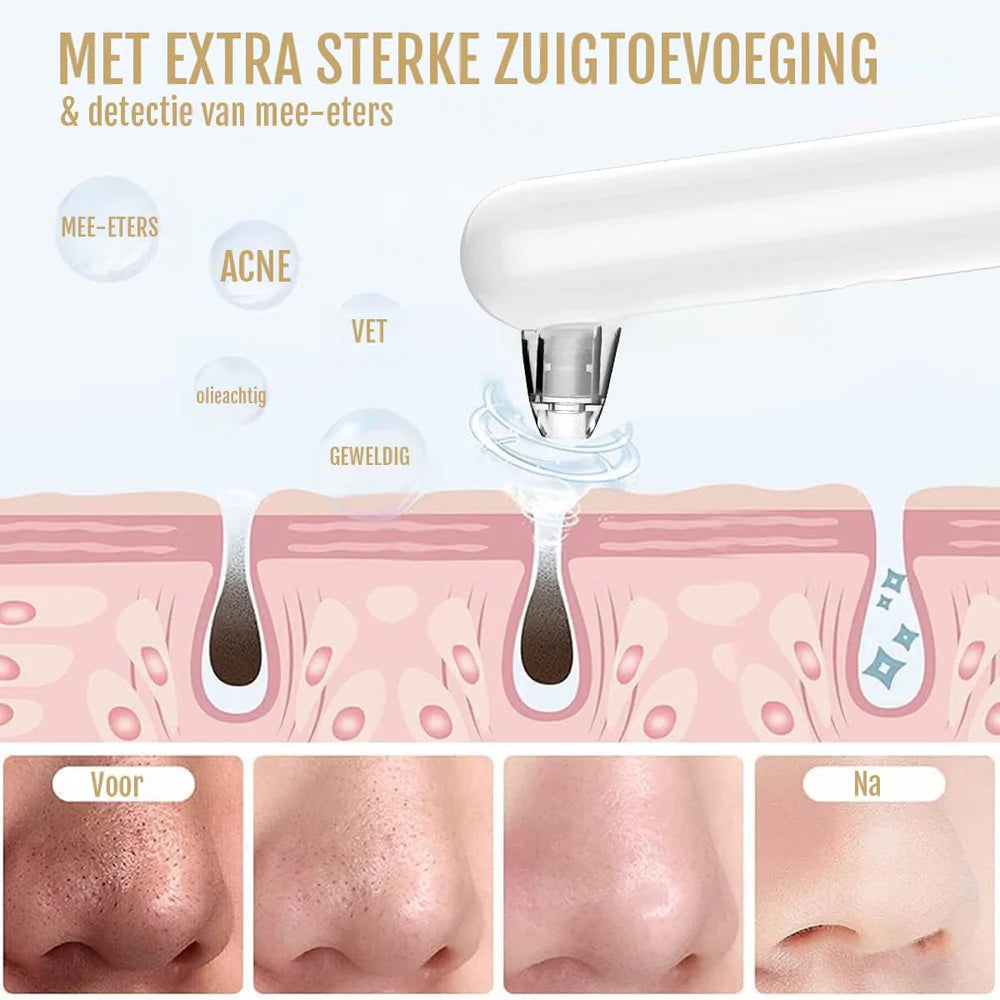PoreGlow Dieptereiniger