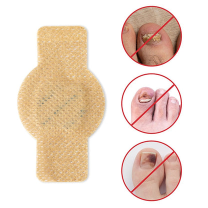 SchimmelStop Pleister – Sterke nagels, zonder gedoe