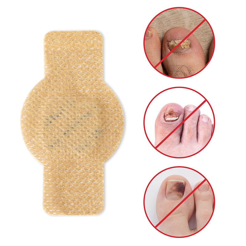 SchimmelStop Pleister – Sterke nagels, zonder gedoe