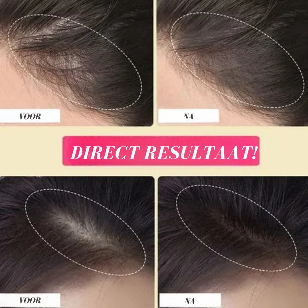 HairPerfect – Vol Haar & Onzichtbare Uitgroei in 1 Seconde