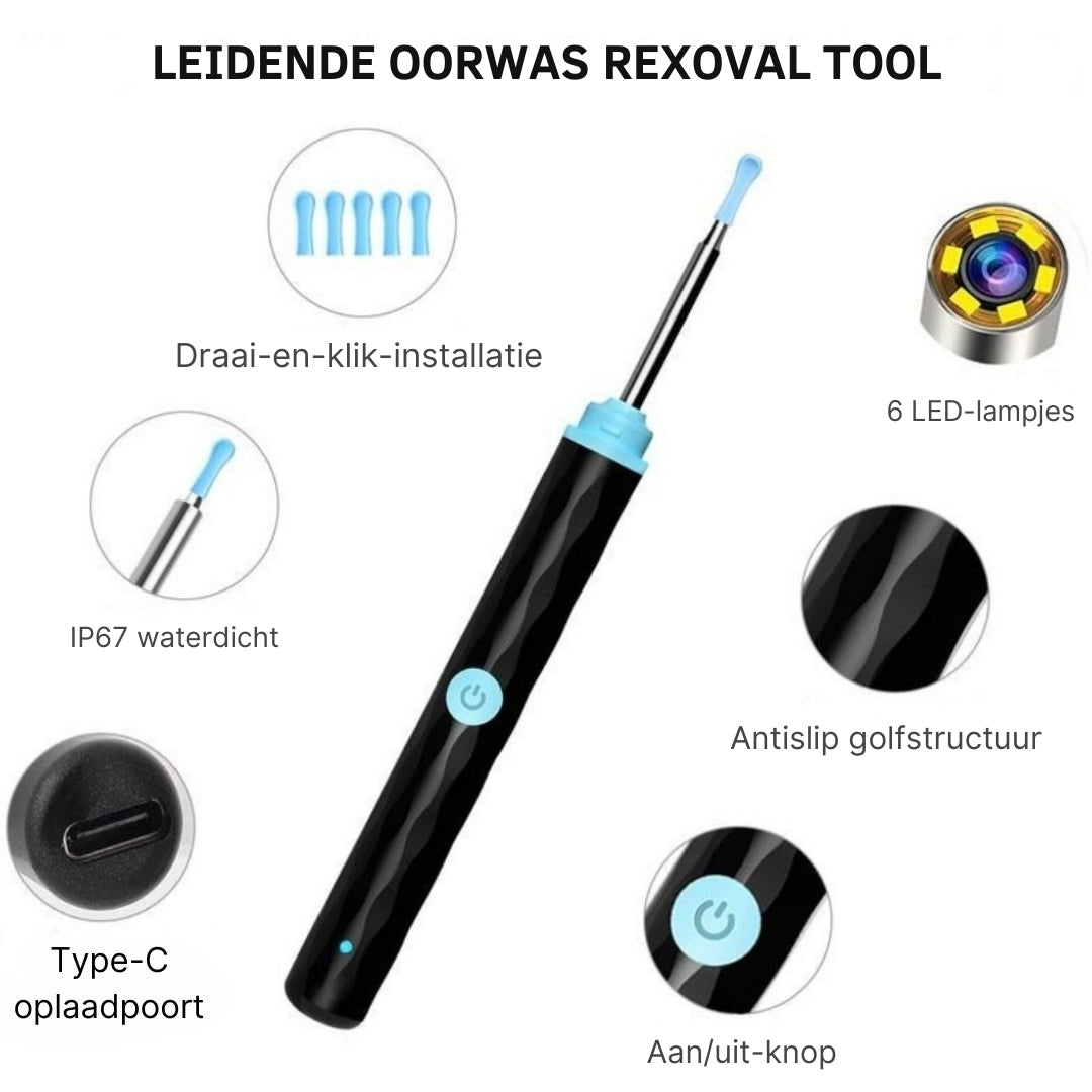 EarView Smart – Geavanceerde Oorreiniging met HD-Camera