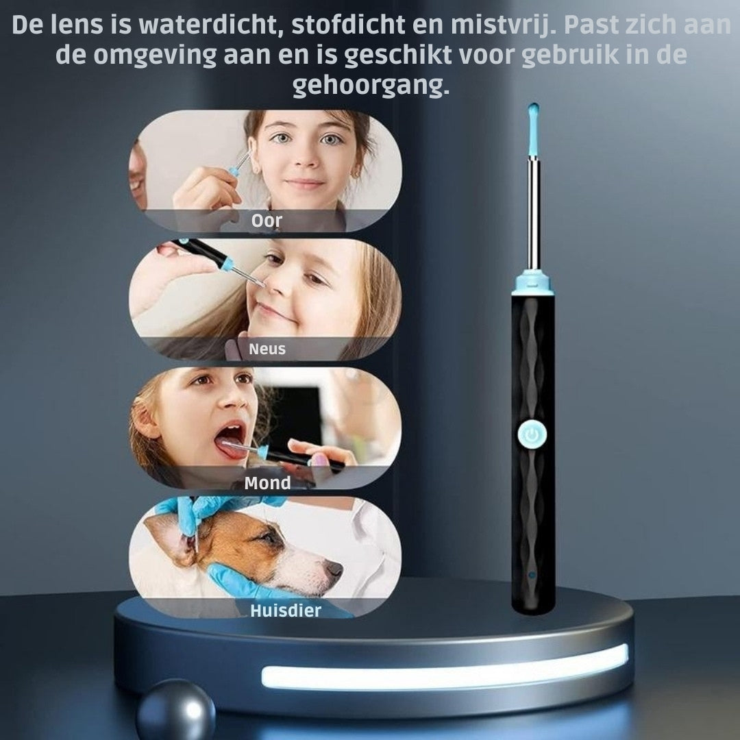 EarView Smart – Geavanceerde Oorreiniging met HD-Camera