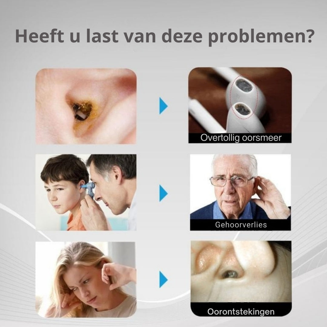 EarView Smart – Geavanceerde Oorreiniging met HD-Camera