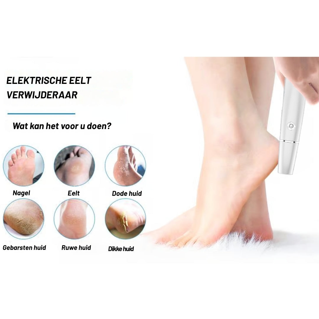 SoftFeet Pro – Direct van ruwe hielen naar zijdezachte voeten