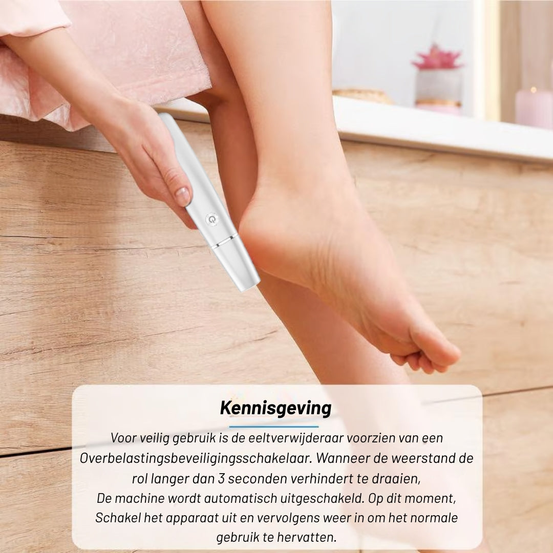 SoftFeet Pro – Direct van ruwe hielen naar zijdezachte voeten