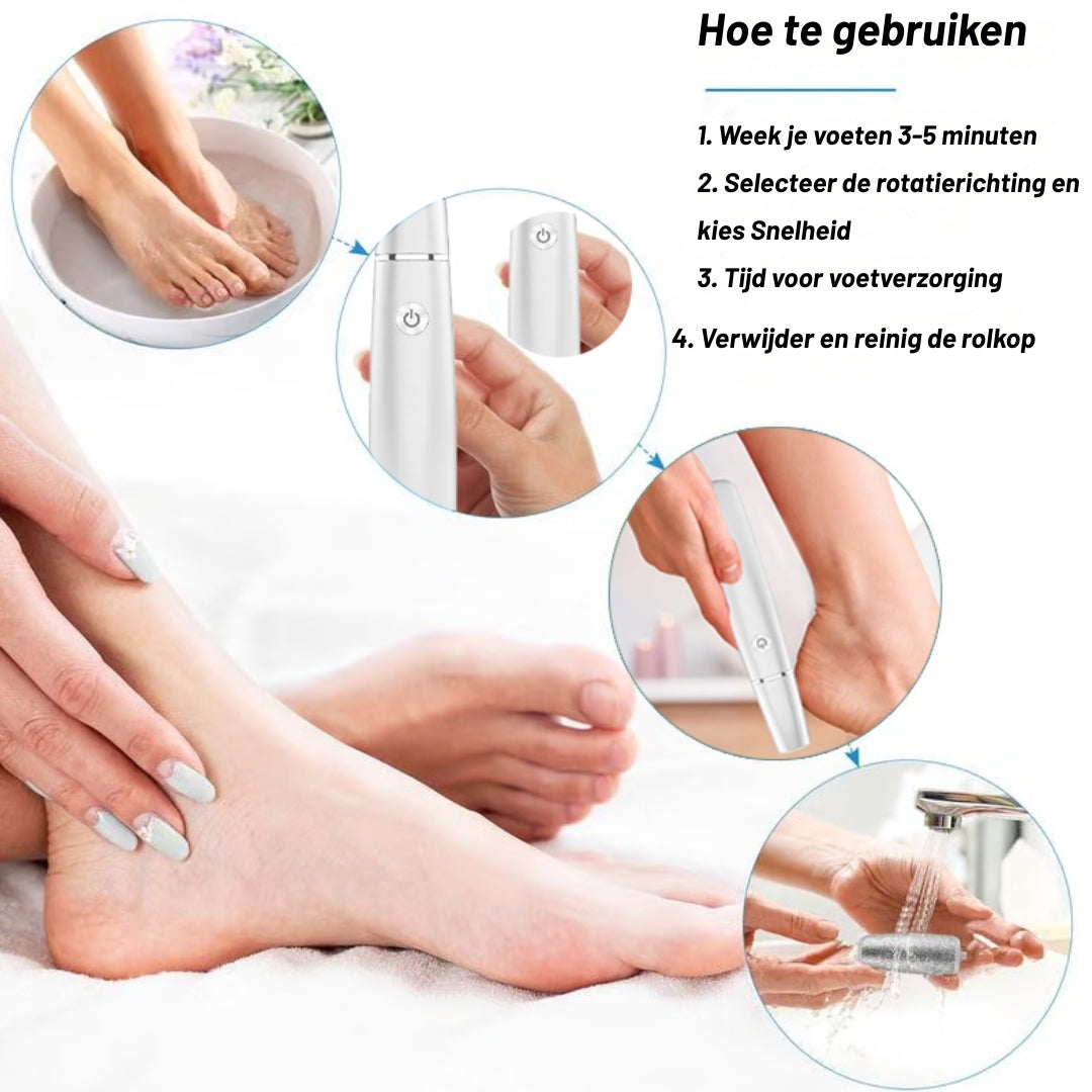 SoftFeet Pro – Direct van ruwe hielen naar zijdezachte voeten