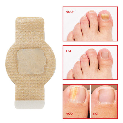 SchimmelStop Pleister – Sterke nagels, zonder gedoe