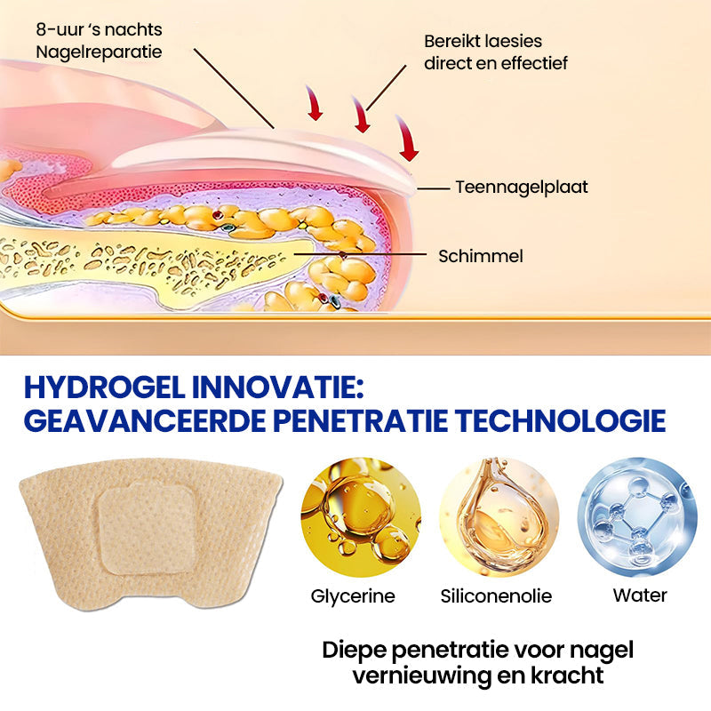 SchimmelStop Pleister – Sterke nagels, zonder gedoe