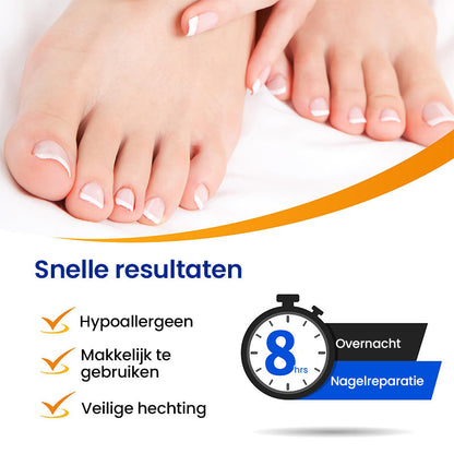 SchimmelStop Pleister – Sterke nagels, zonder gedoe